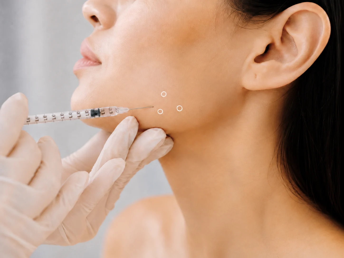 Botulinumtoxin-Injektion in den Kaumuskel bei Bruxismus